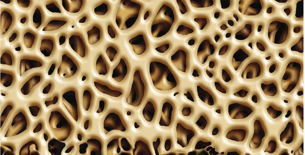 Empfohlene Laboranalysen bei Knochenstoffwechselerkrankungen